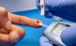 Mortalidad por diabetes tipo II